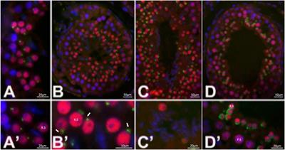 A Non-Synonymous Point Mutation in a WD-40 Domain Repeat of EML5 Leads to Decreased Bovine Sperm Quality and Fertility